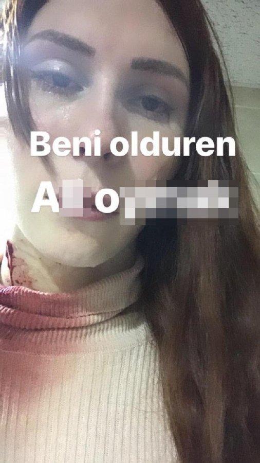Trans birey ölmeden önce WhatsApp'tan isim verdi