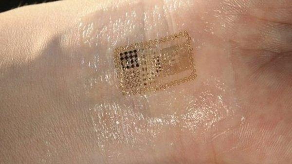 İsveç'te, deri altına yerleştirilen çip sayısı 4 bini geçti