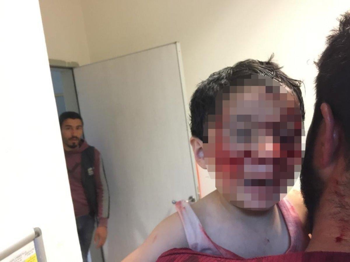 Şanlıurfa'da sokak köpekleri 6 çocuğa saldırdı