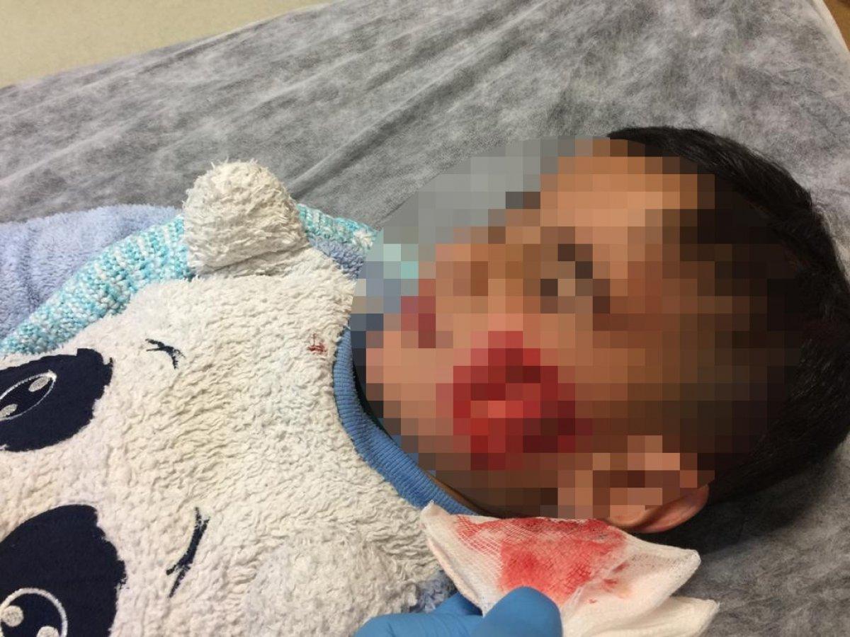 Şanlıurfa'da sokak köpekleri 6 çocuğa saldırdı