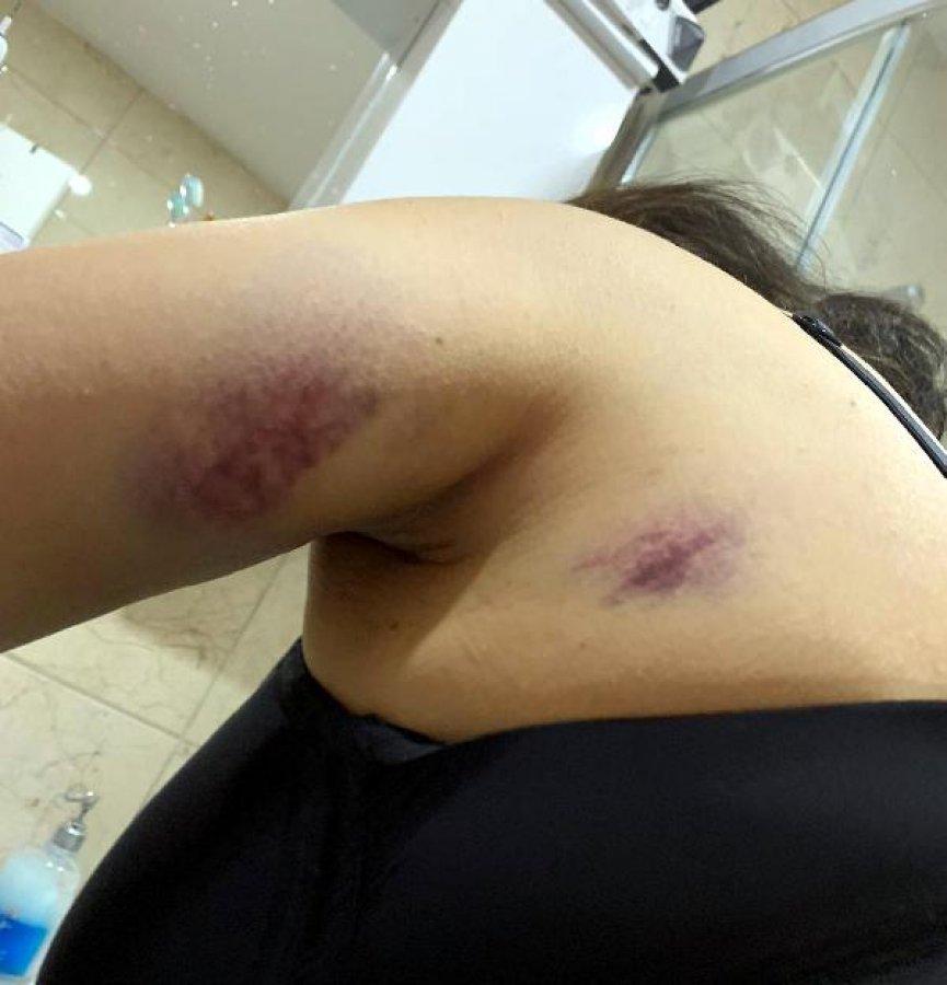 Esenyurt'ta eski eşini kaçırıp, darbeden zanlı tutuklandı