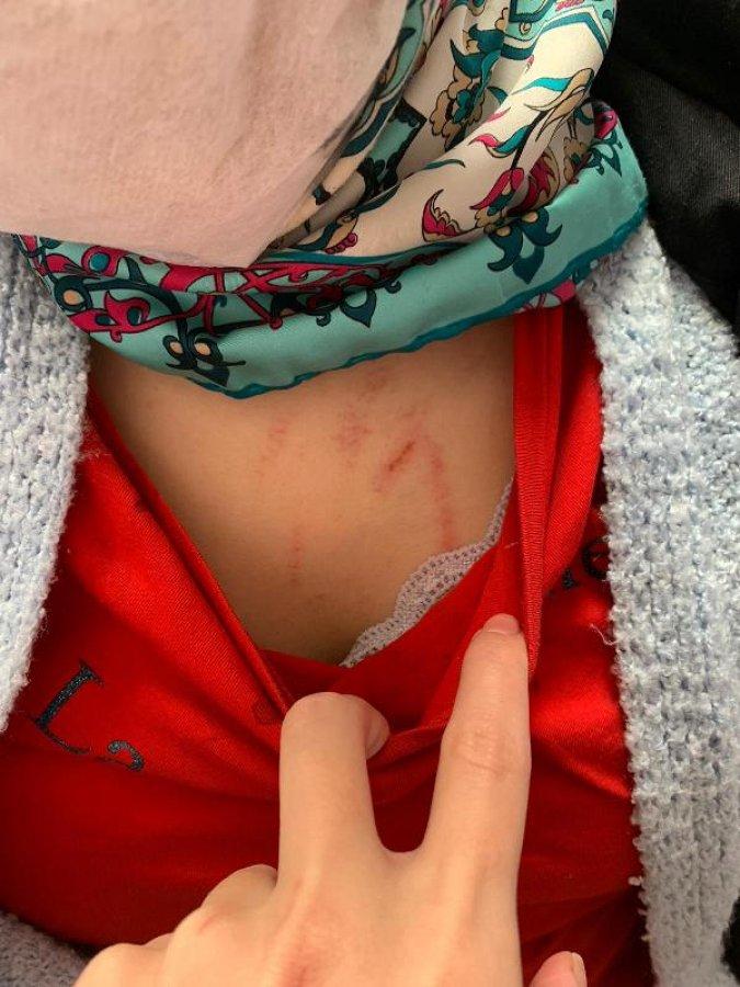 Esenyurt'ta eski eşini kaçırıp, darbeden zanlı tutuklandı