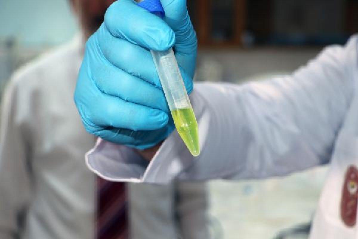 Çukurova Üniversitesi, koronaya alternatif tedavi geliştirdi