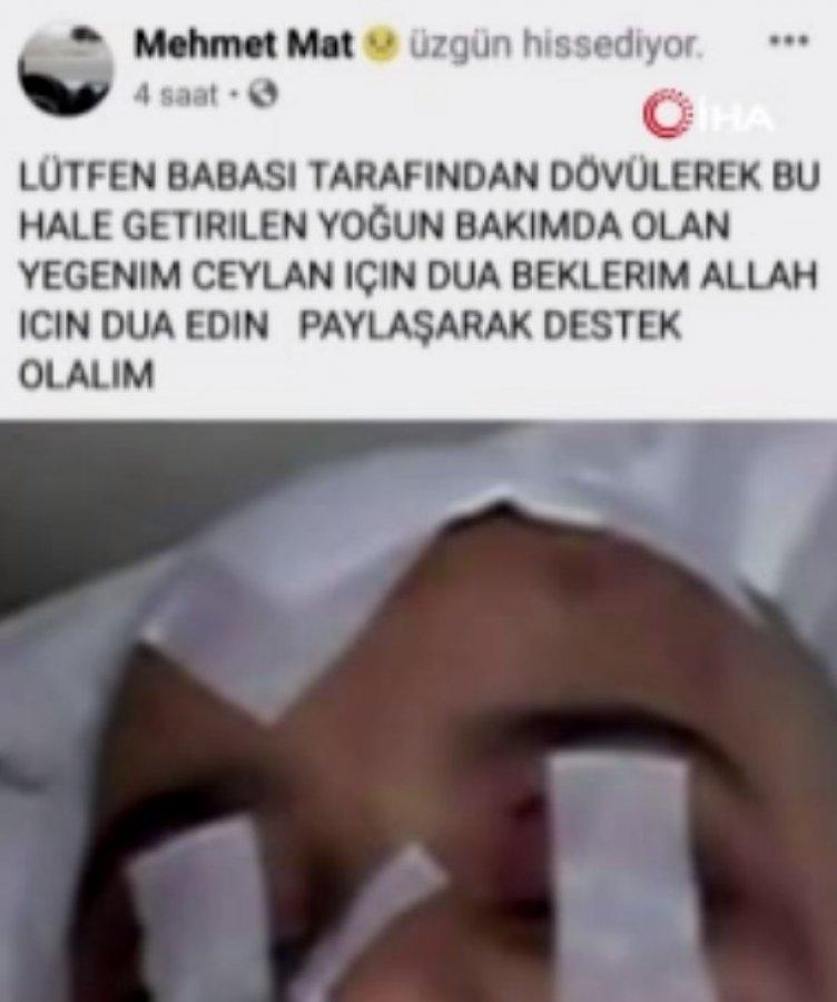 Babası 11 yaşındaki kız çocuğunu döverek öldürdü