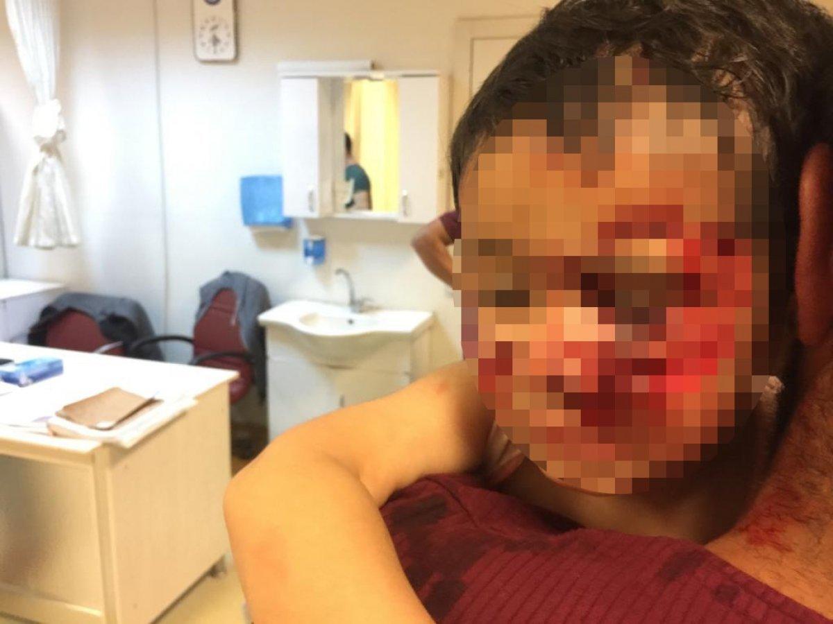 Şanlıurfa'da şimdi de bir sokak köpeği öldürüldü