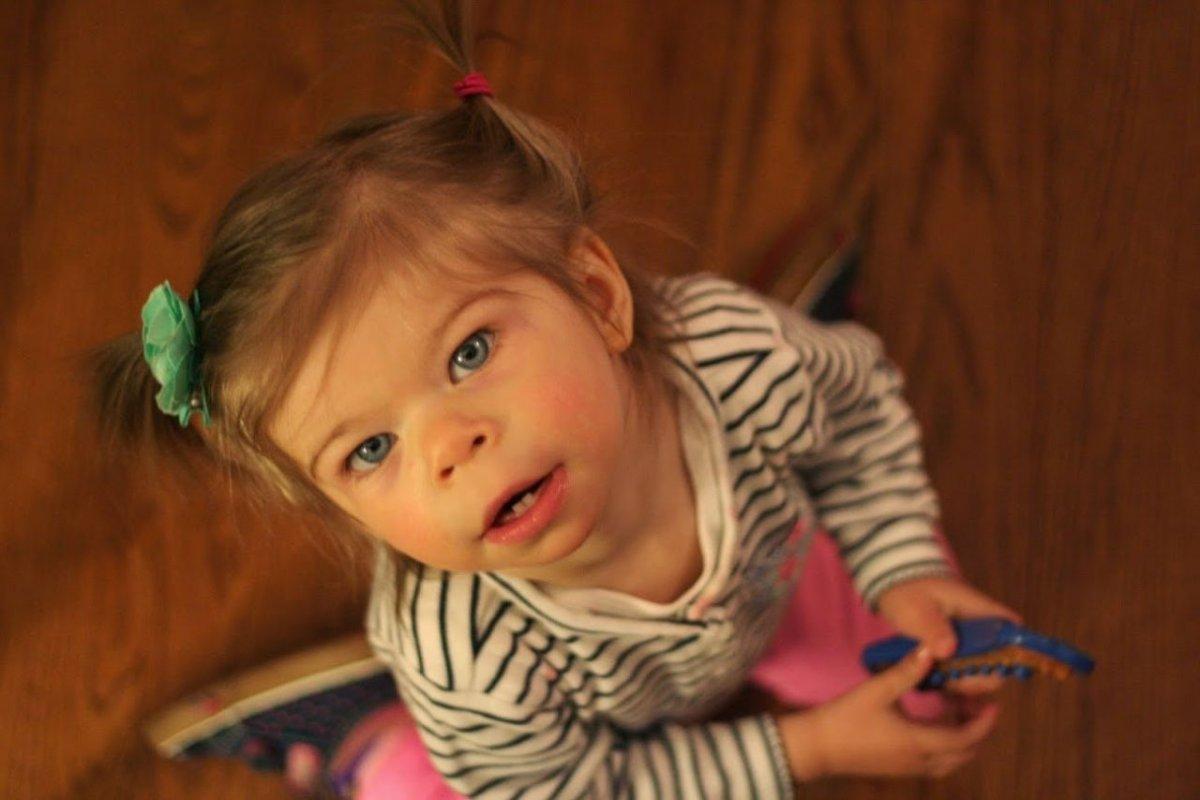 Williams sendromu nedir