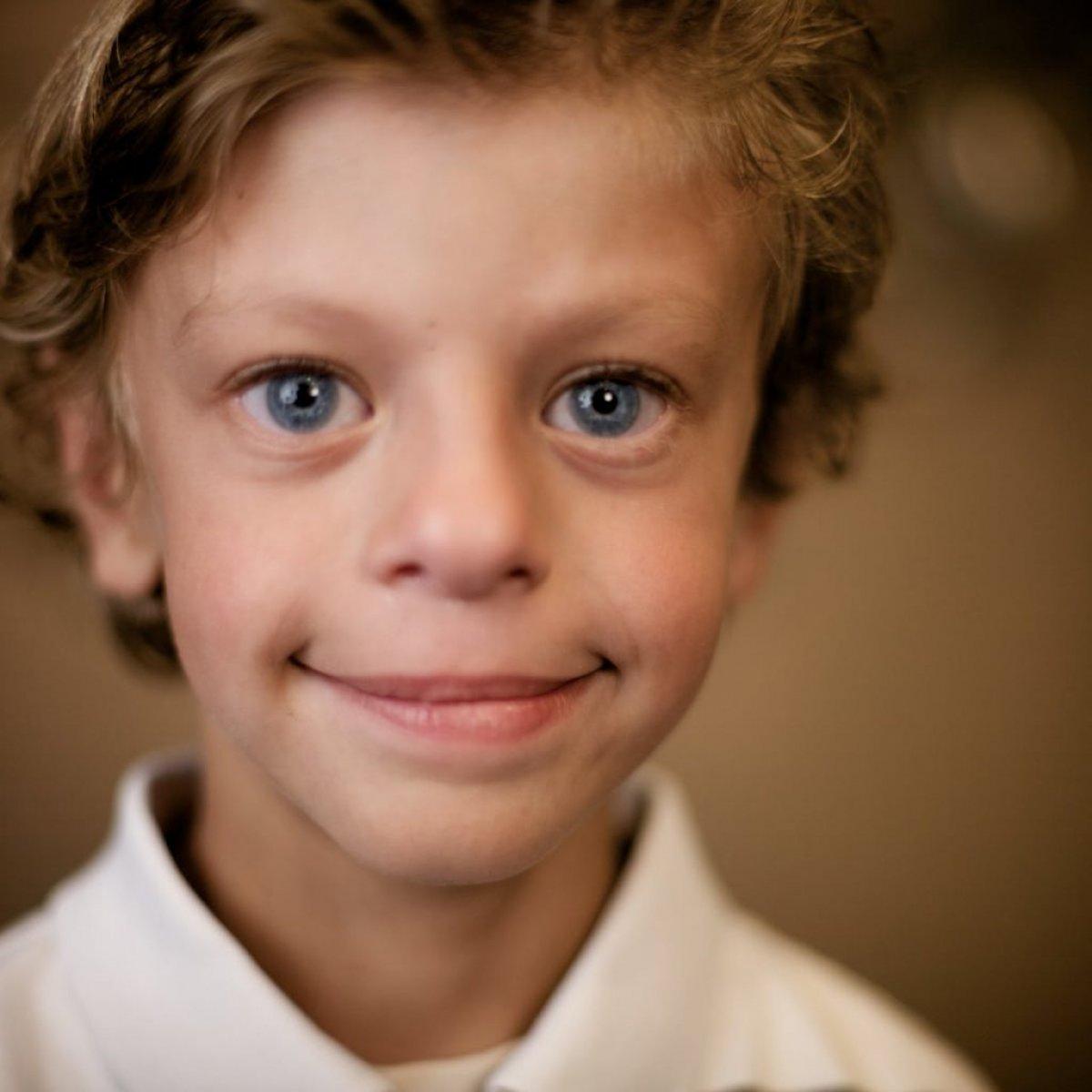 Williams sendromu nedir