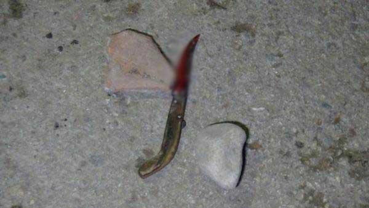 Ablasıyla boşanma aşamasında olan eniştesini bıçakladı