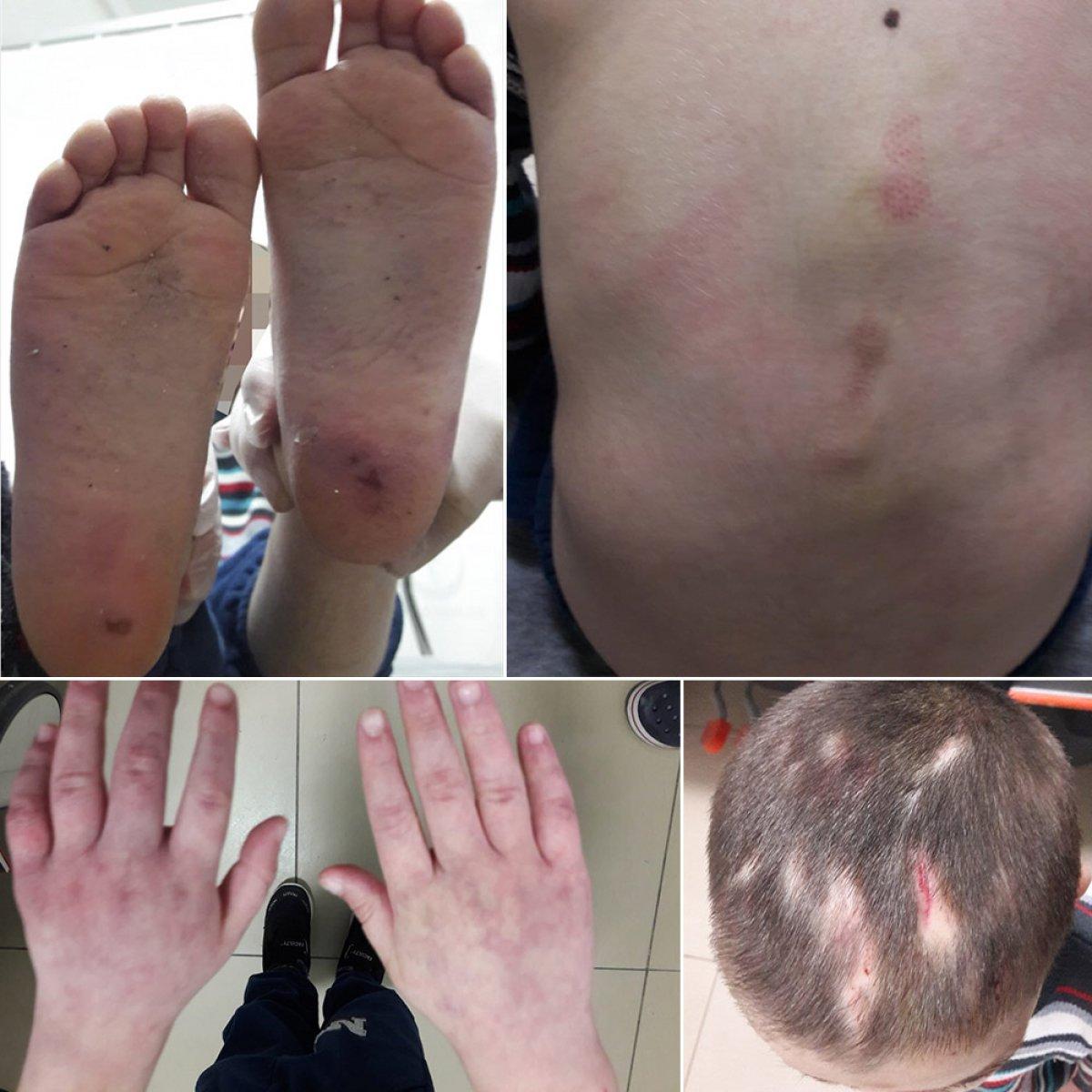 Tekirdağ'da 7 yaşındaki çocuğu üvey babası darbetti