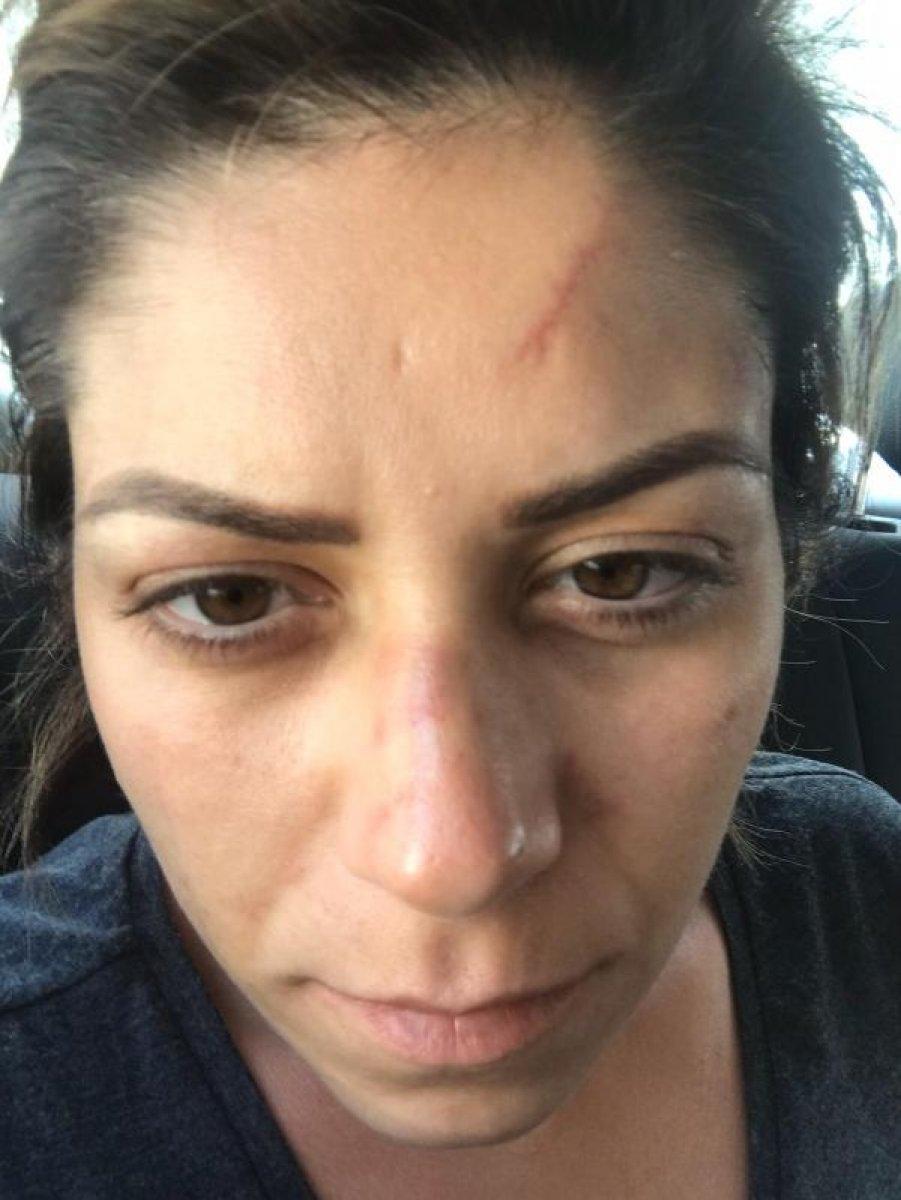 İzmit’te kadın avukat, eski eşinden şiddet gördü