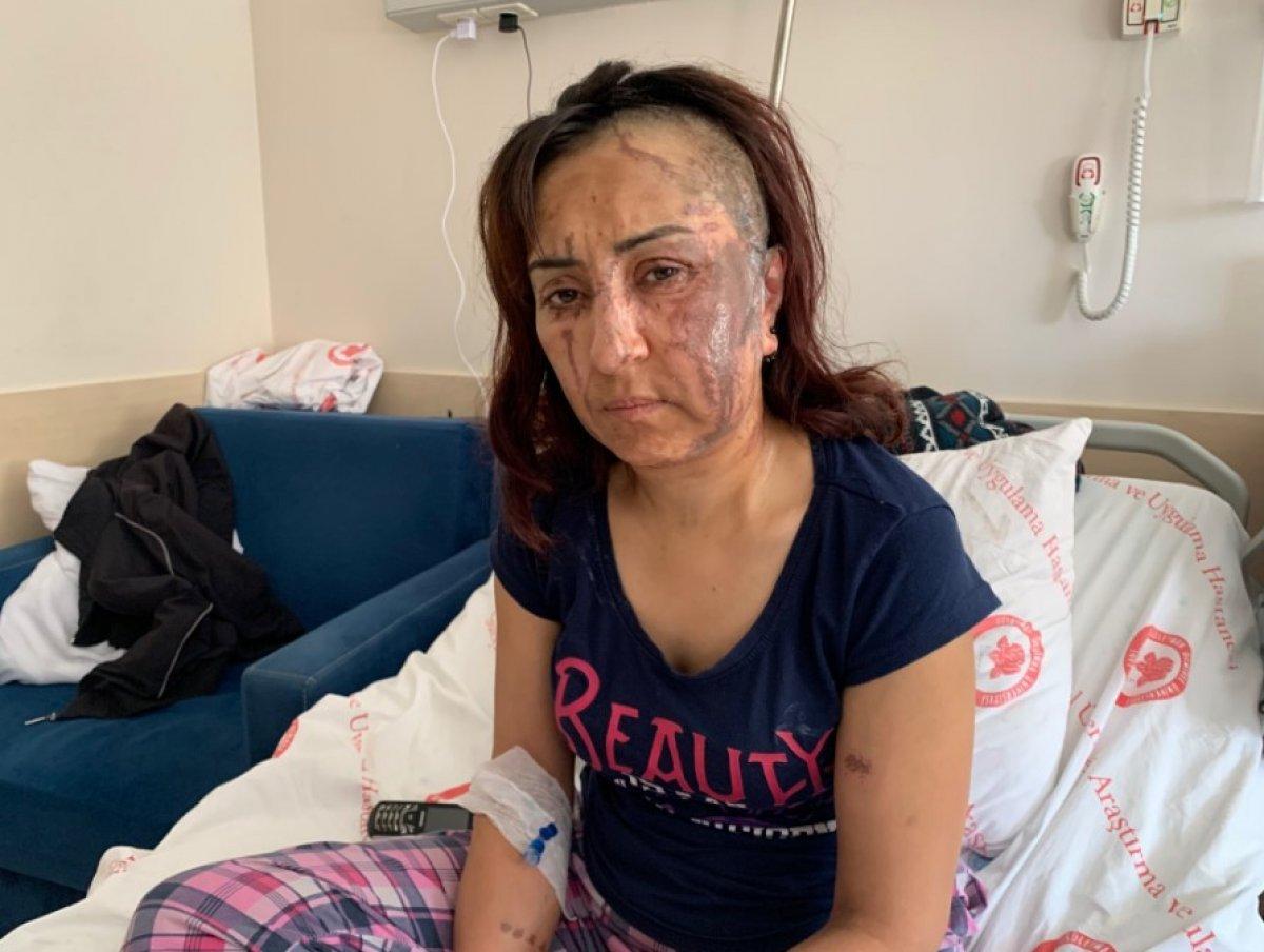 Isparta’da boşanmak isteyen kadına kezzaplı saldırı