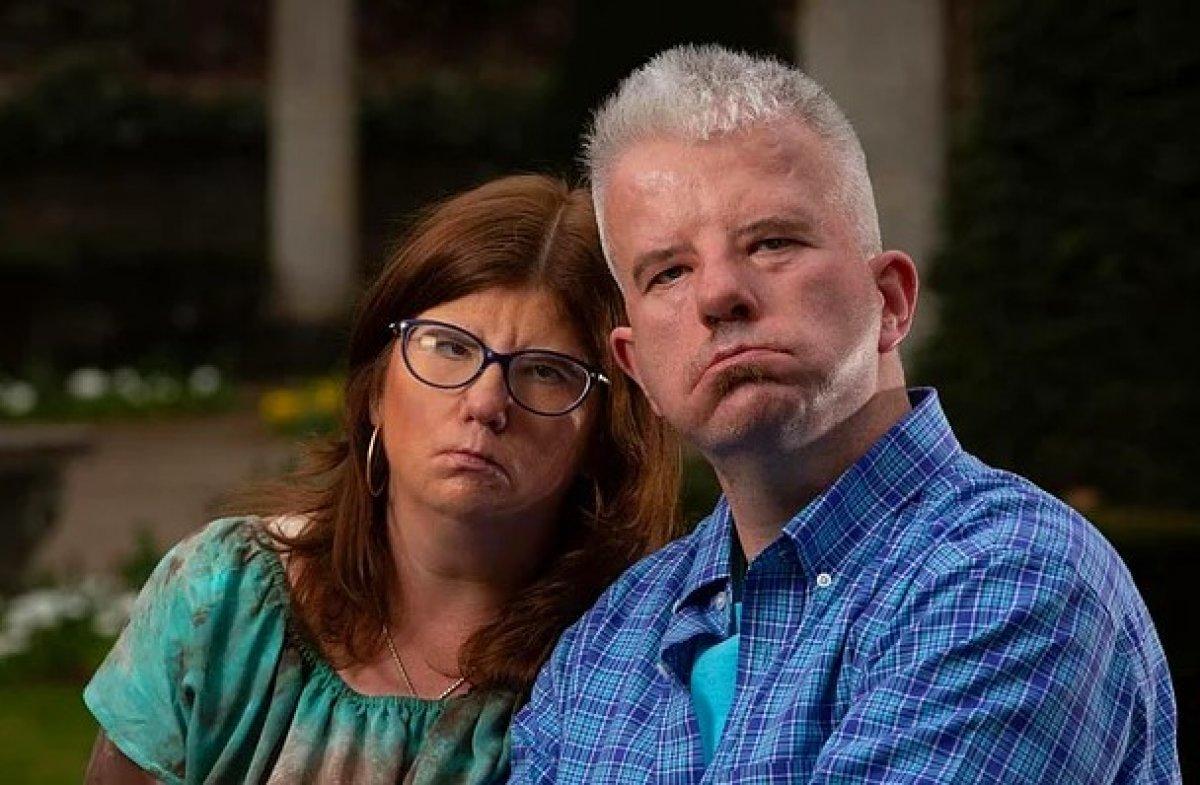 Moebius sendromu nedir