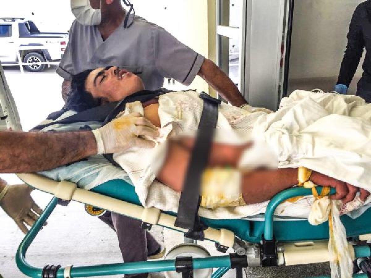 Antalya'da, serada akıma kapılan genç ağır yaralandı