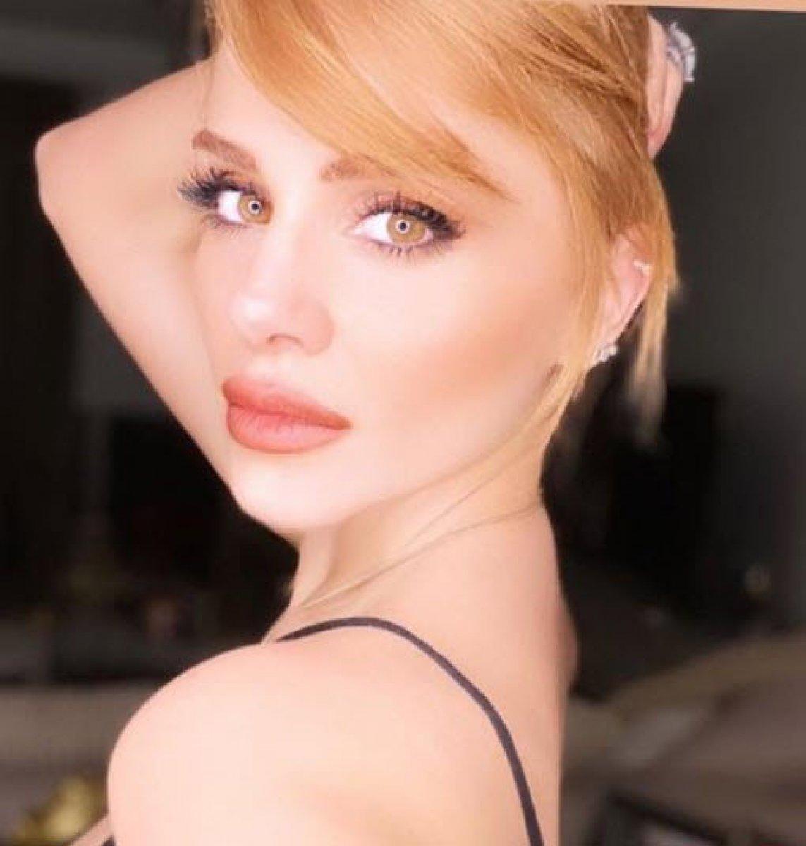 Azeri kızı Günel'in son hali