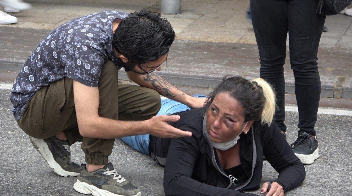 Denizli'de köpekten korkan kadın motosikletten düştü