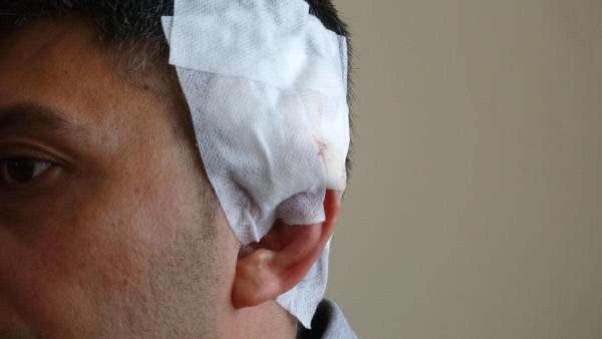 Afyonkarahisar'da kürekle yaralanan karakol amiri konuştu