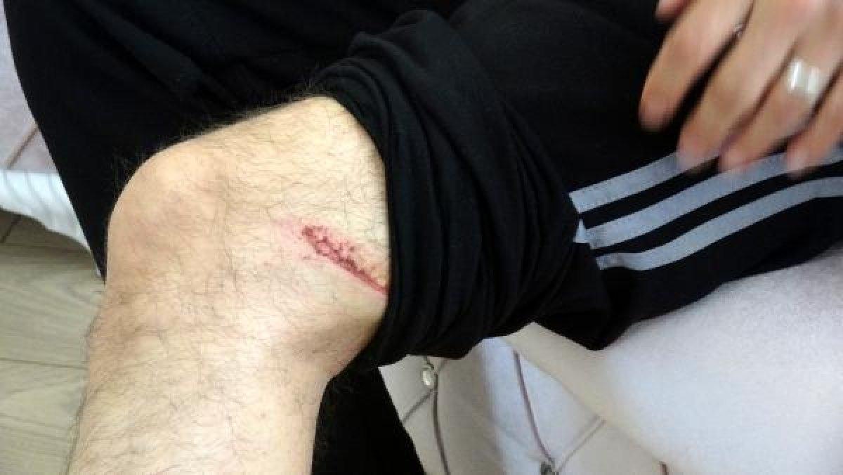 Afyonkarahisar'da kürekle yaralanan karakol amiri konuştu