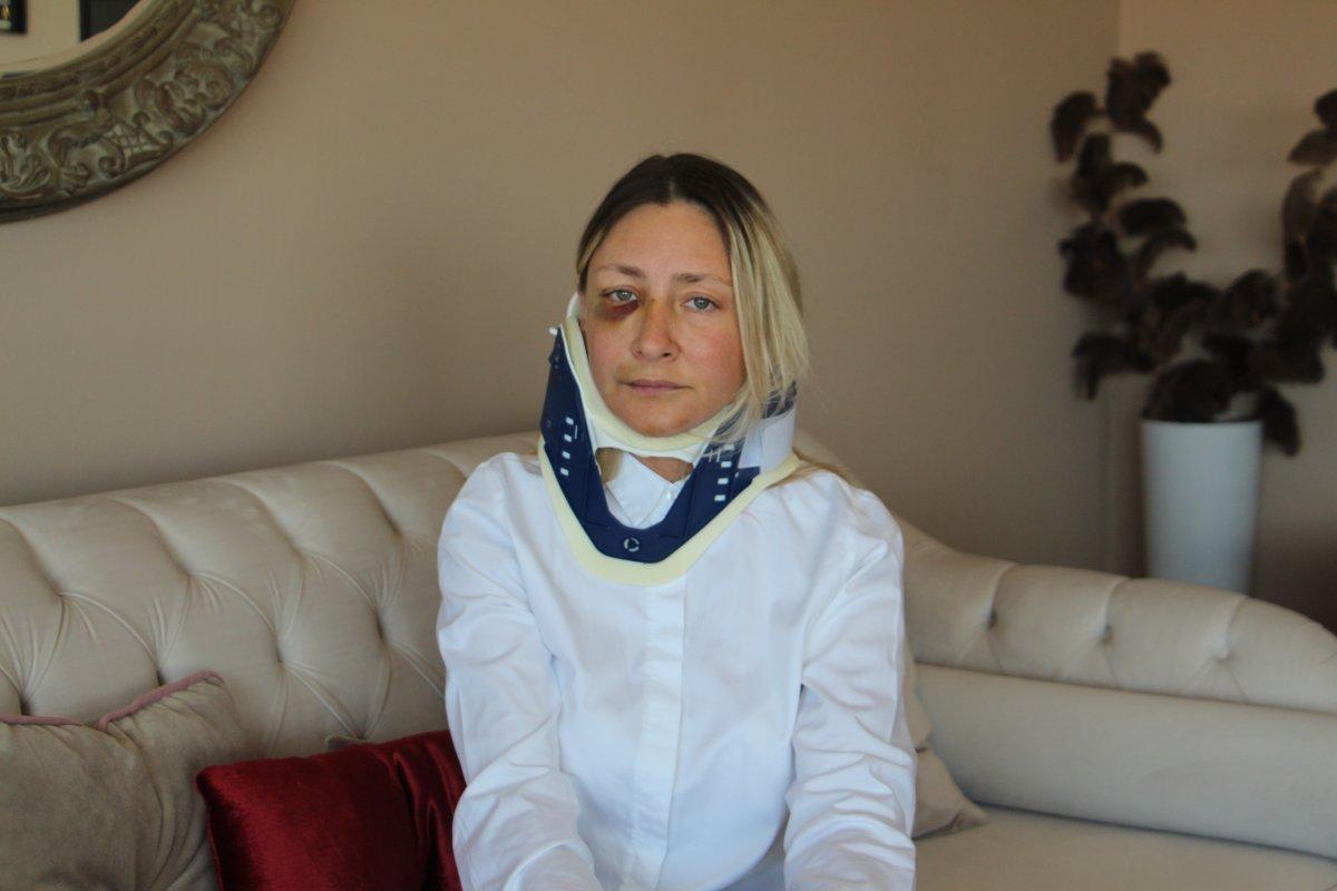 Kuşadası'nda saldırıya uğrayan banka müdürü konuştu