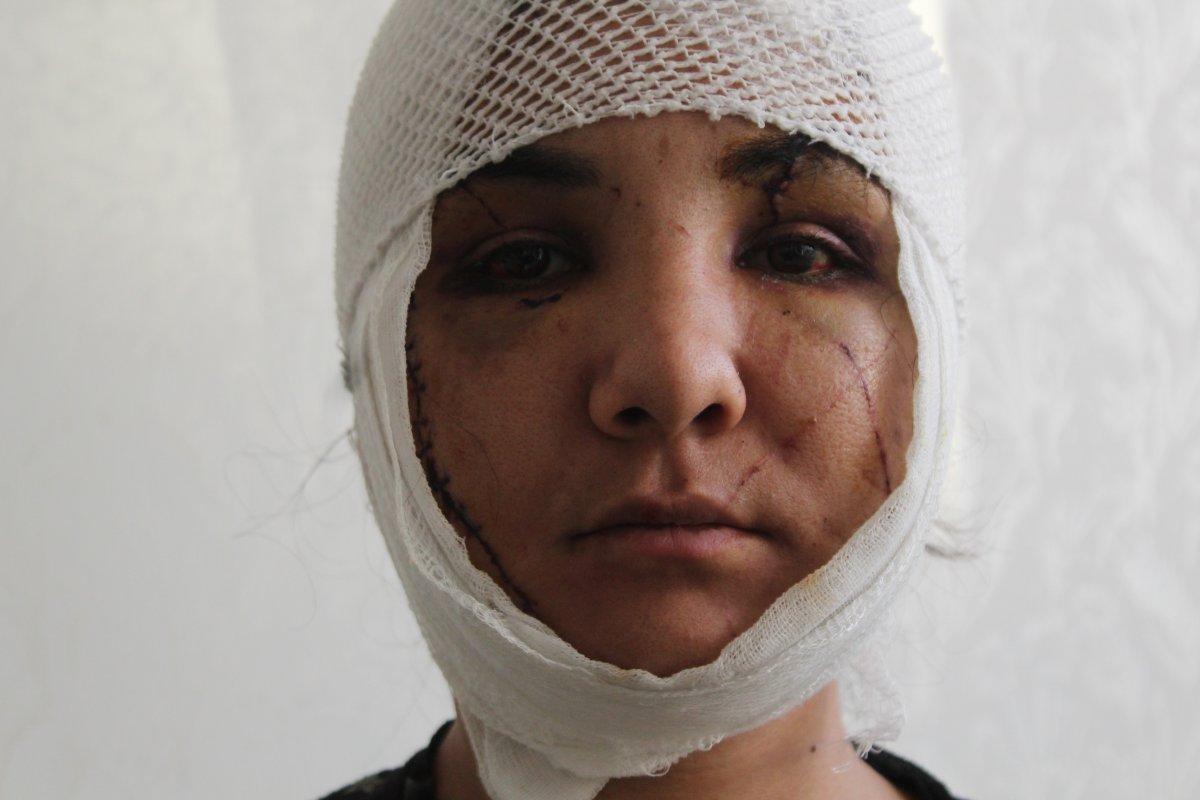 6 yıllık eşi tarafından yüzünden bıçaklandı