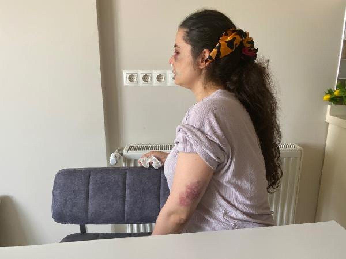 Kartal'da boşanmak istediği eşi tarafından darbedildi