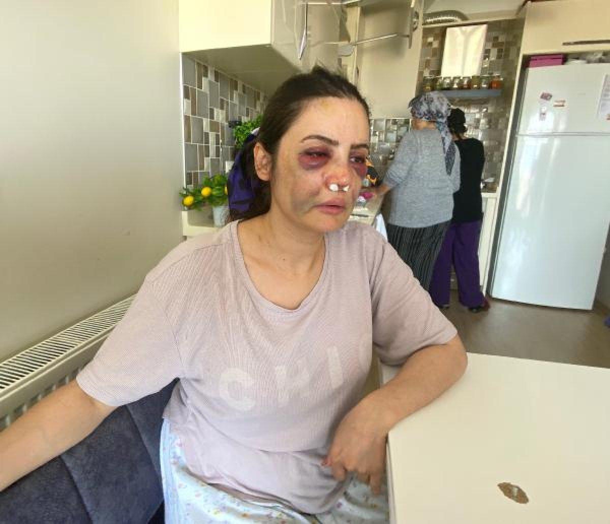 Kartal'da boşanmak istediği eşi tarafından darbedildi