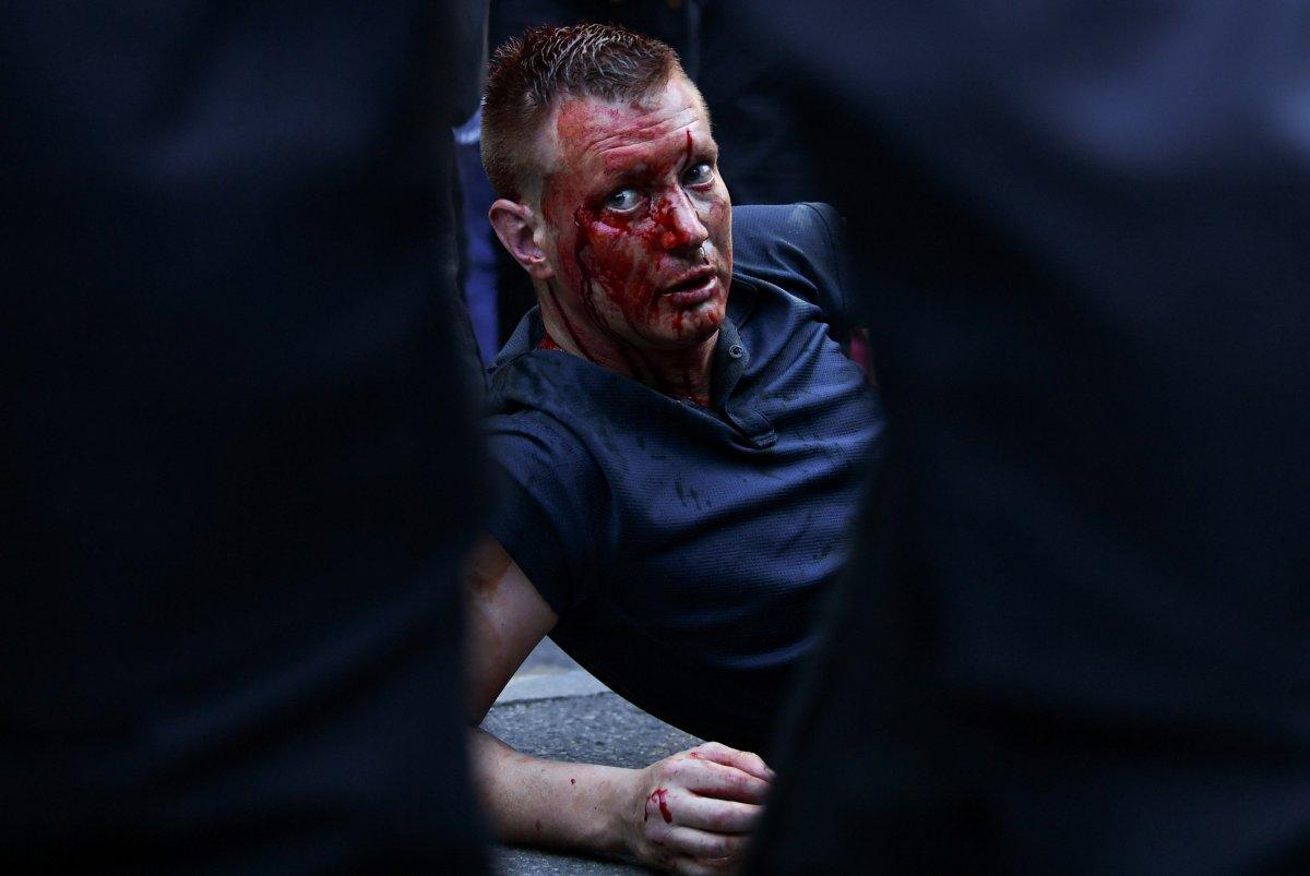 İngiltere'de ırkçıları linçten siyahiler kurtardı