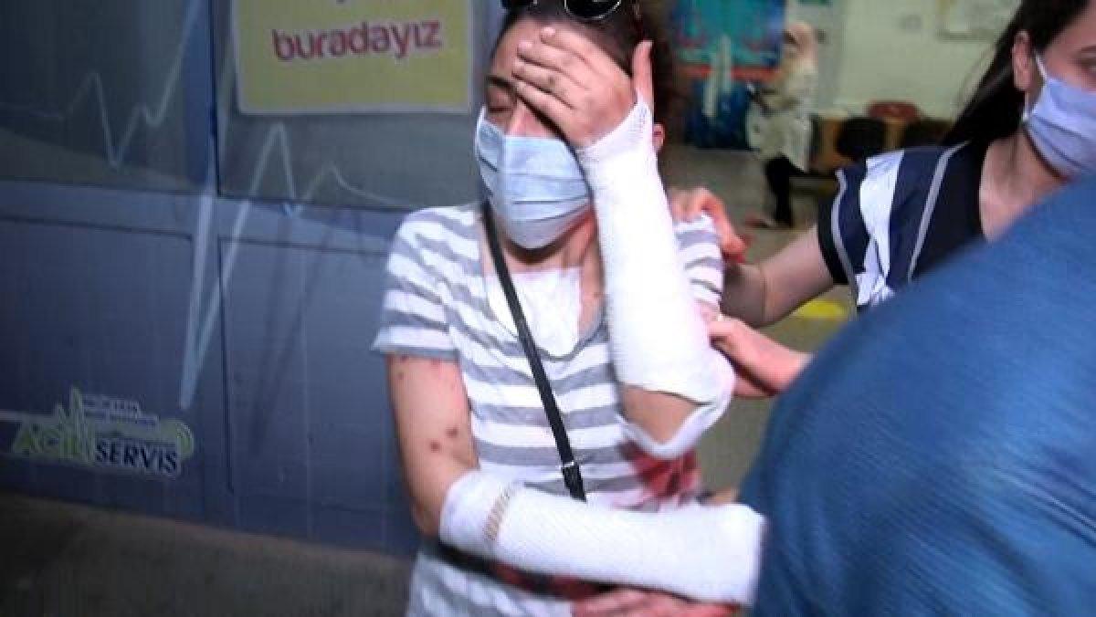 Eski sevgilisinin yüzüne kezzap atan kadın, korona çıktı