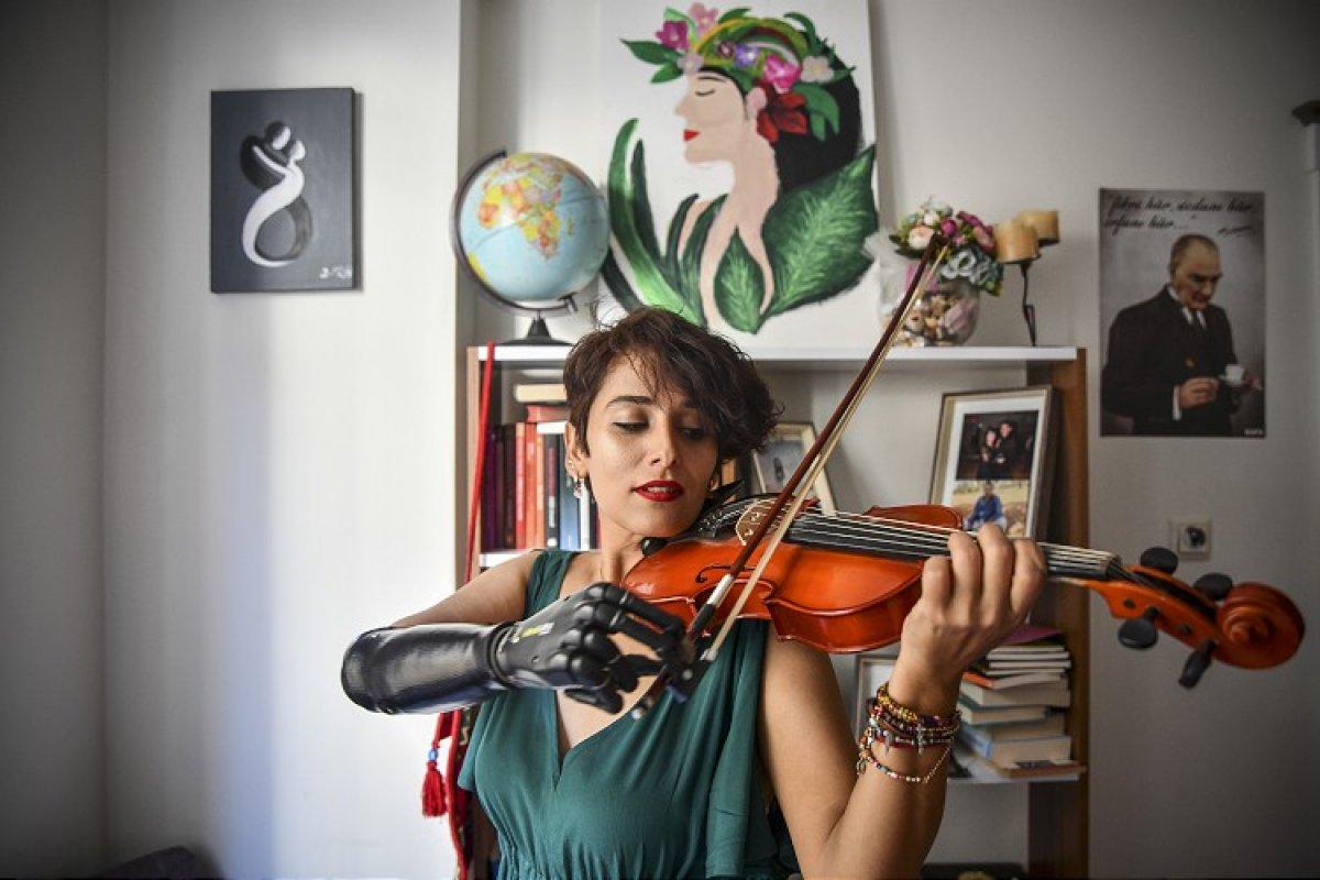 Gaziantepli Zübeyde, biyonik koluyla hayata tutundu