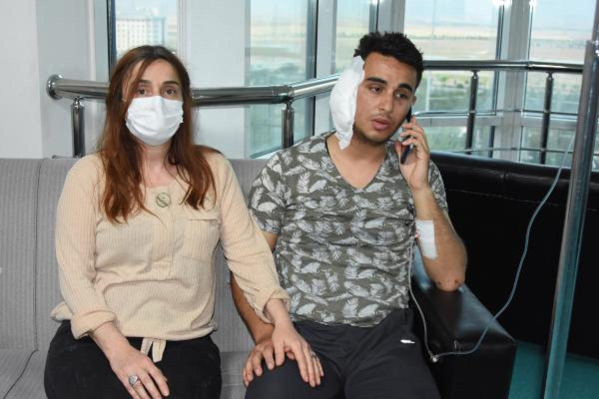 Köpek kavgasında postacının kulağı ısırıldı