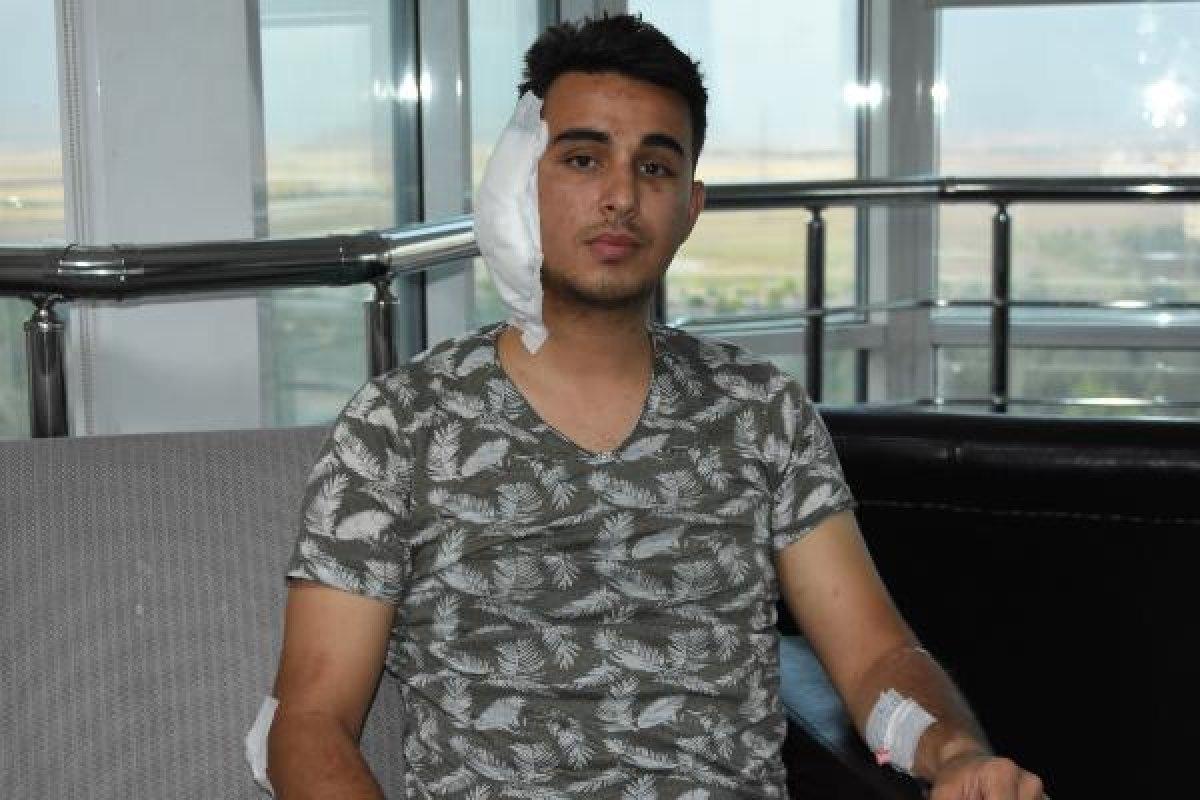 Köpek kavgasında postacının kulağı ısırıldı