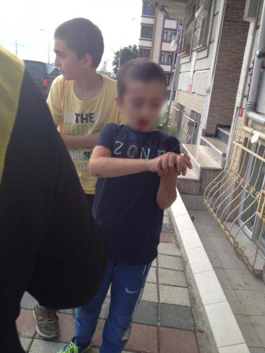 Sultangazi'de 8 yaşındaki Ubeyde'ye köpek saldırdı