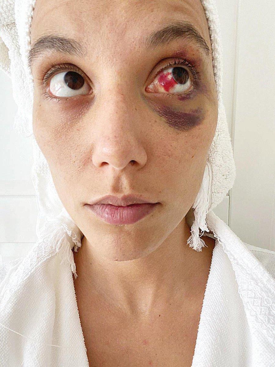 Deniz Bulutsuz'un darp sonrası fotoğrafı ortaya çıktı