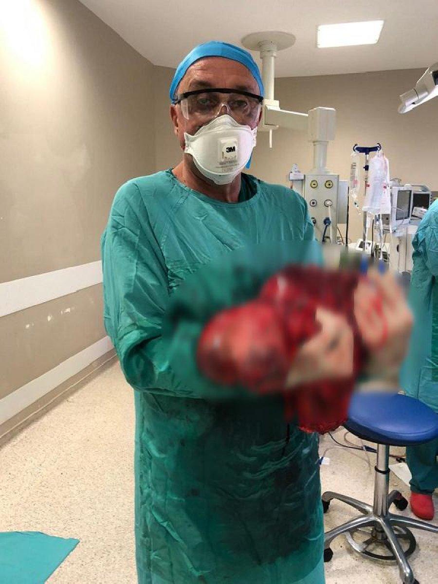 İstanbul’da yaşlı adamın karnından 10 kiloluk tümör çıktı