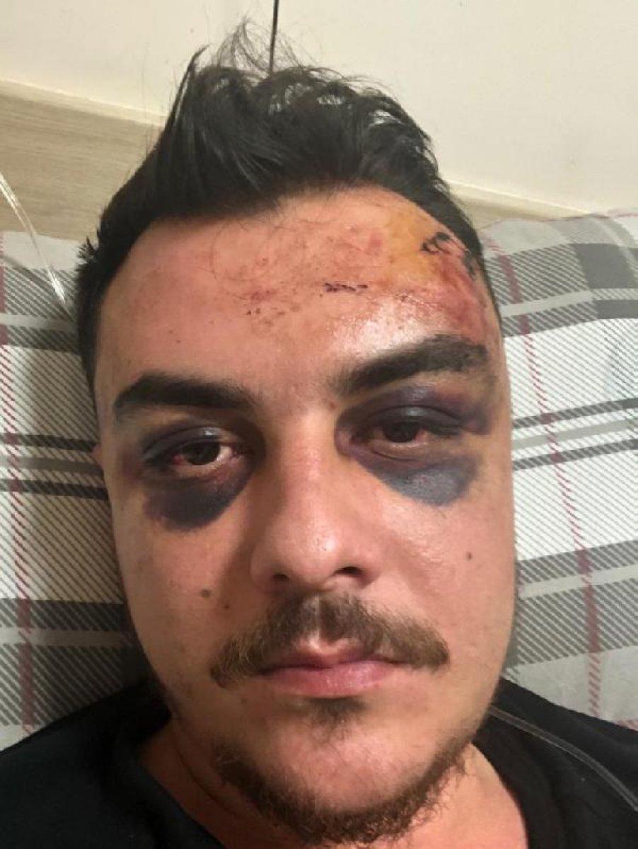 Mersin’de 4 kişinin dövdüğü genç komadan çıktı