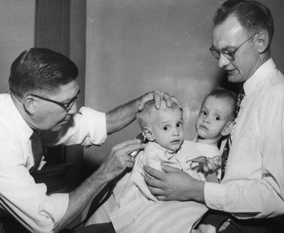 Dünyanın en yaşlı yapışık ikizleri öldü