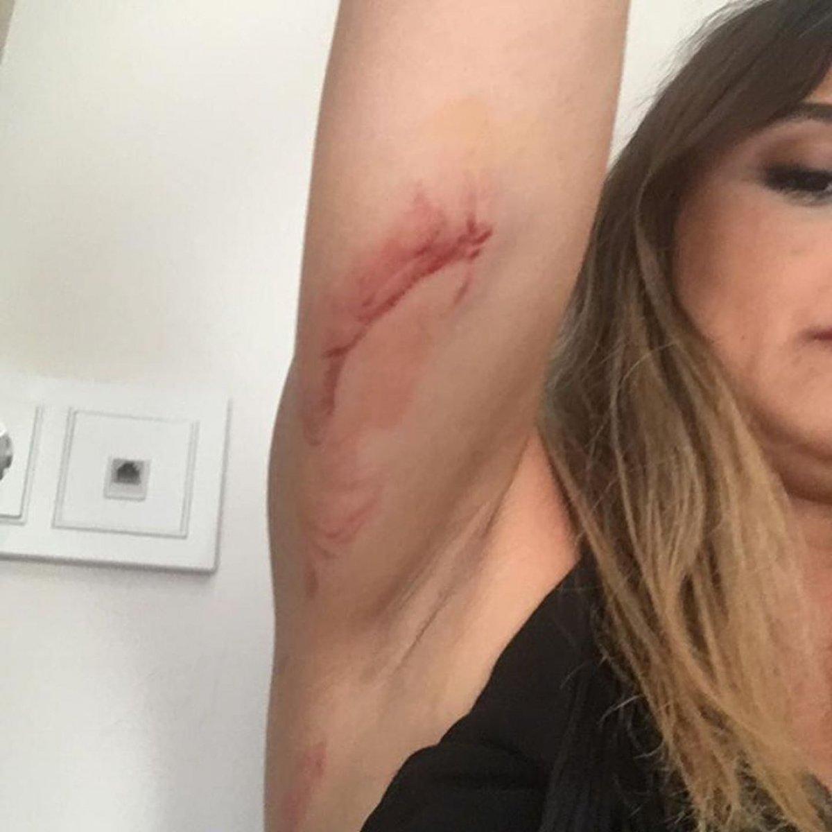 Zeynep Tandoğan ölümden döndü