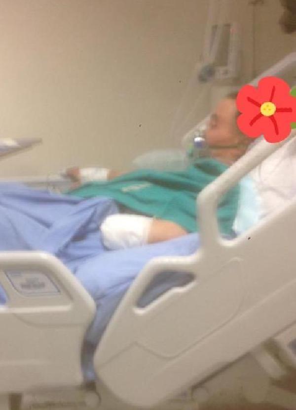 Trabzon'da 3 köpeğin saldırısına uğradı, kolunu kaybetti