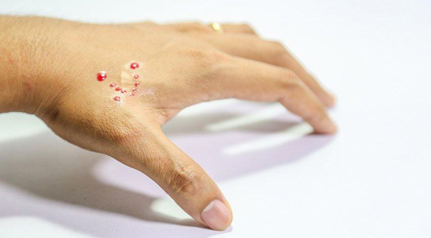 Antalya'da düğünde fenalaşan küçük çocuk vefat etti