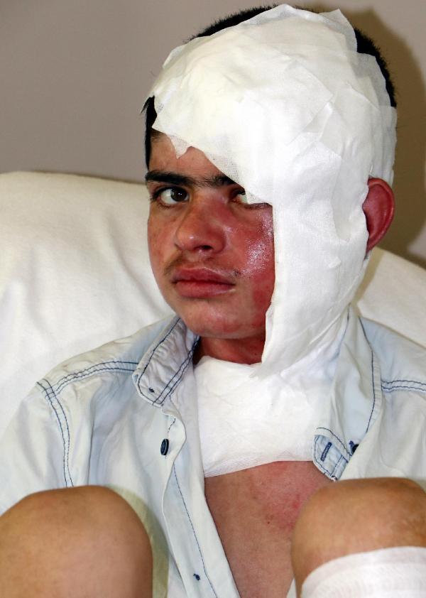 Kars'ta 13 yaşındaki çocuk elektrik akımını kapıldı