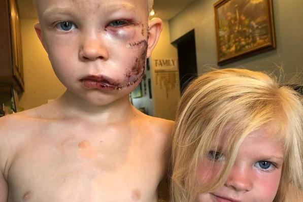 ABD'de kardeşini köpek saldırısından kurtardı