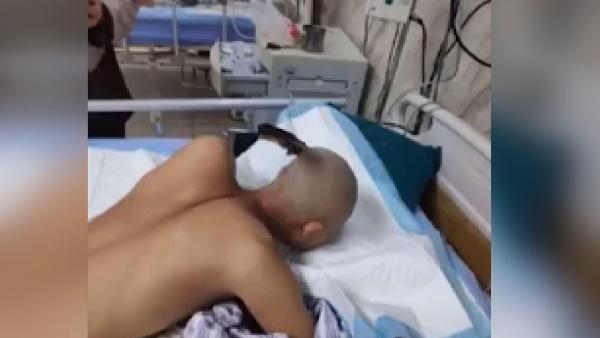 Çin'de kafasına bıçak saplanan adamın sakin tavırları