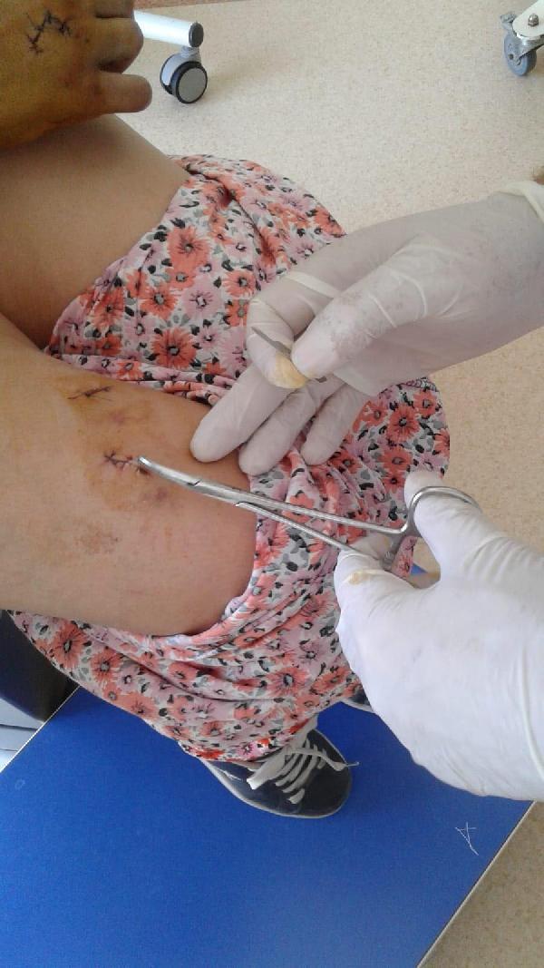 Eskişehir'de eşini 15 yerinden bıçaklayan koca: Bipolarım