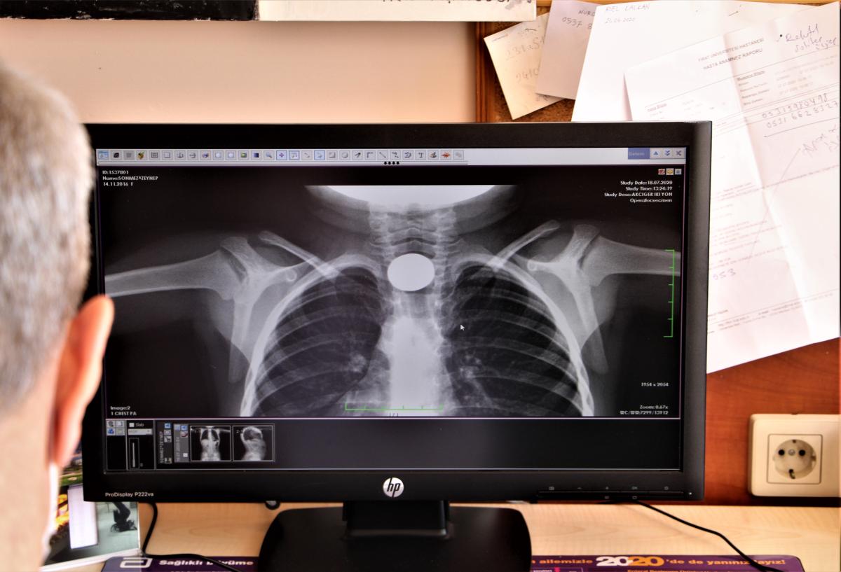 Çocukların midesinden onlarca yabancı cisim çıktı