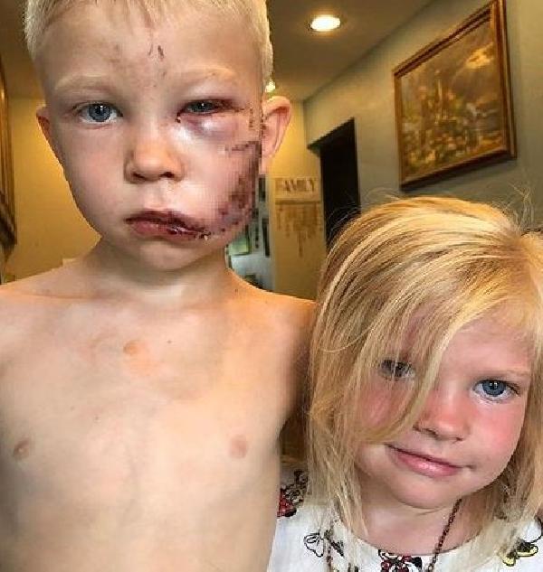 ABD’de kardeşini köpekten kurtaran çocuğa jest