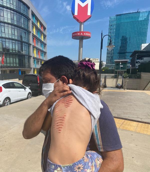 Saçları yürüyen merdivene sıkışan çocuğun son hali