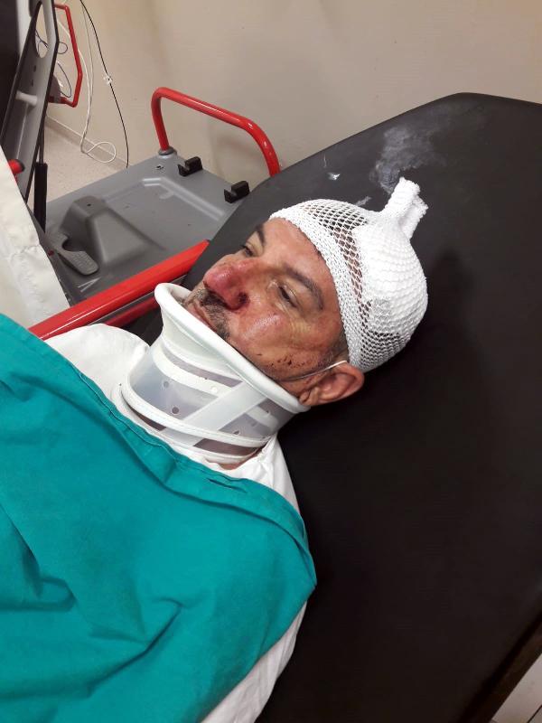 Adana’da yeni otomobil için dünüründen dayak yedi