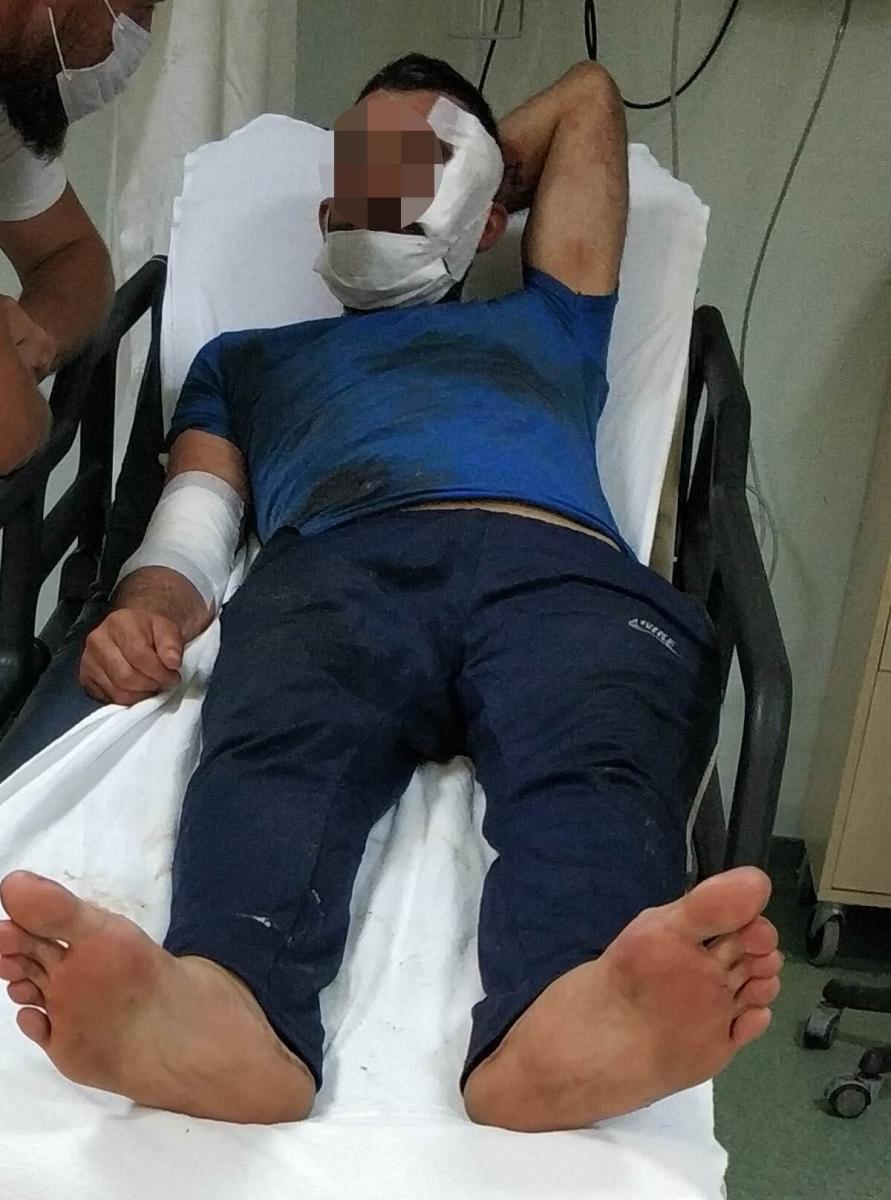 Samsun'da genç kadın kocasını bıçakla yaraladı