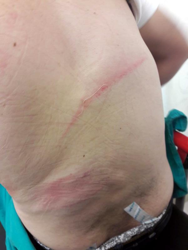 Adana’da yeni otomobil için dünüründen dayak yedi