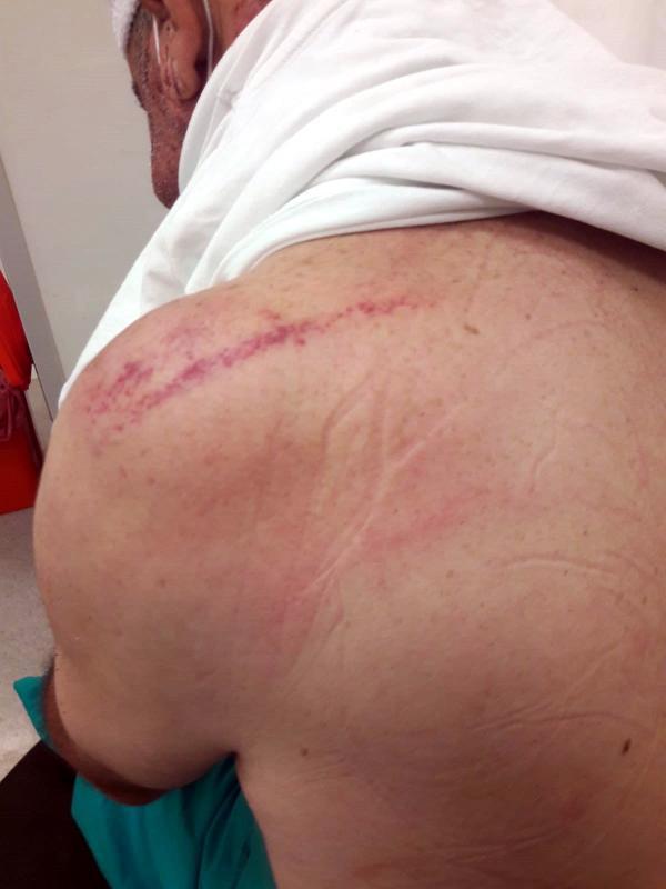 Adana’da yeni otomobil için dünüründen dayak yedi