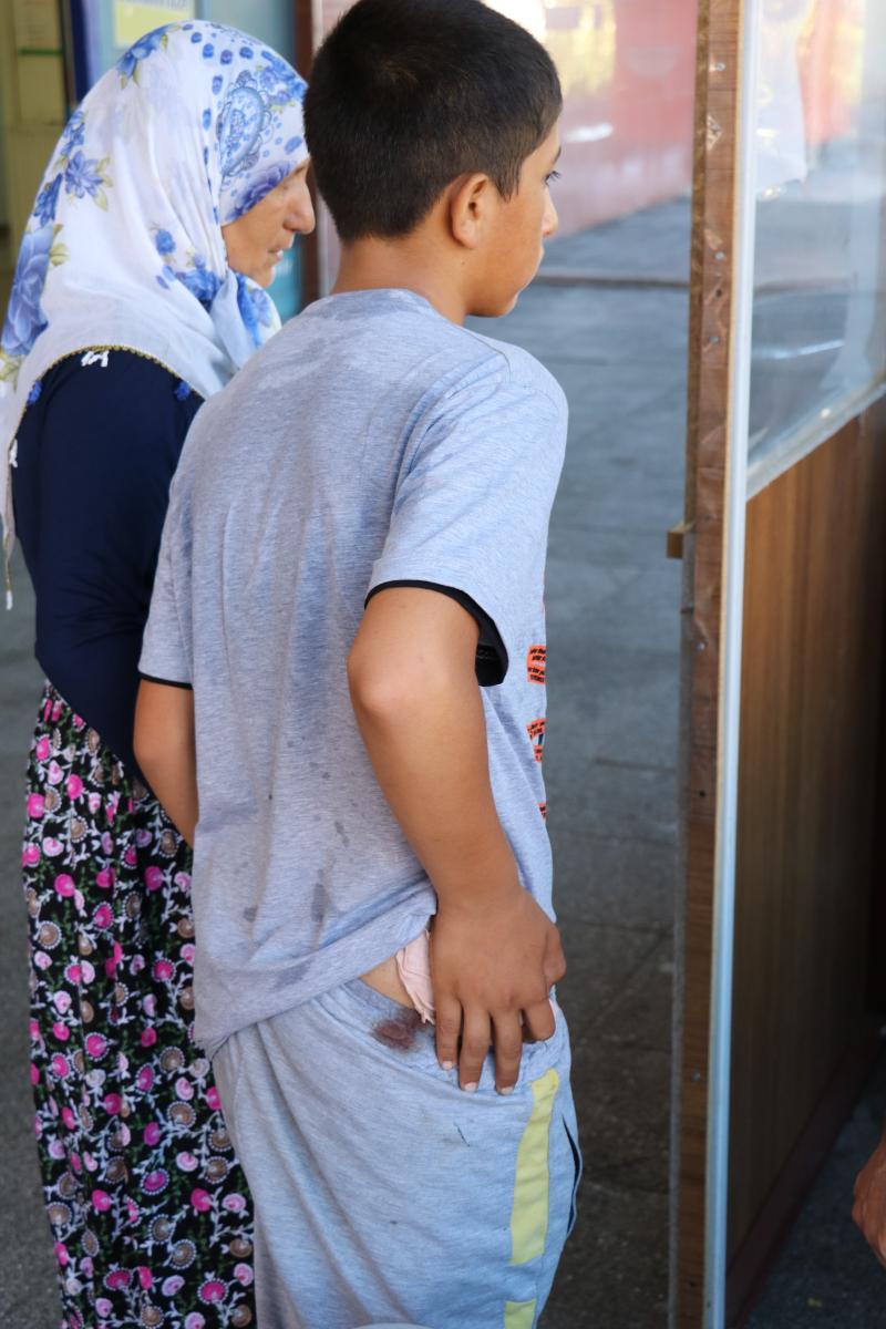 Acemi kasaplar hastanelik oldu